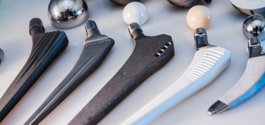 эндопротезирование