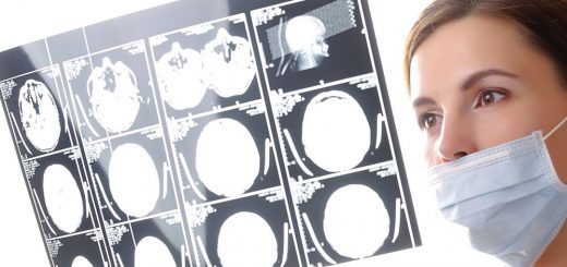 Кортексин купить